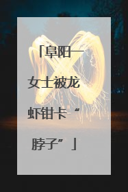 阜阳一女士被龙虾钳卡“脖子”
